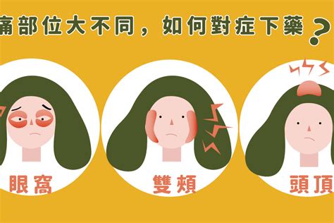 頭痛|頭痛怎麼辦？何時該就醫？秒懂頭痛原因、位置及症狀｜元氣